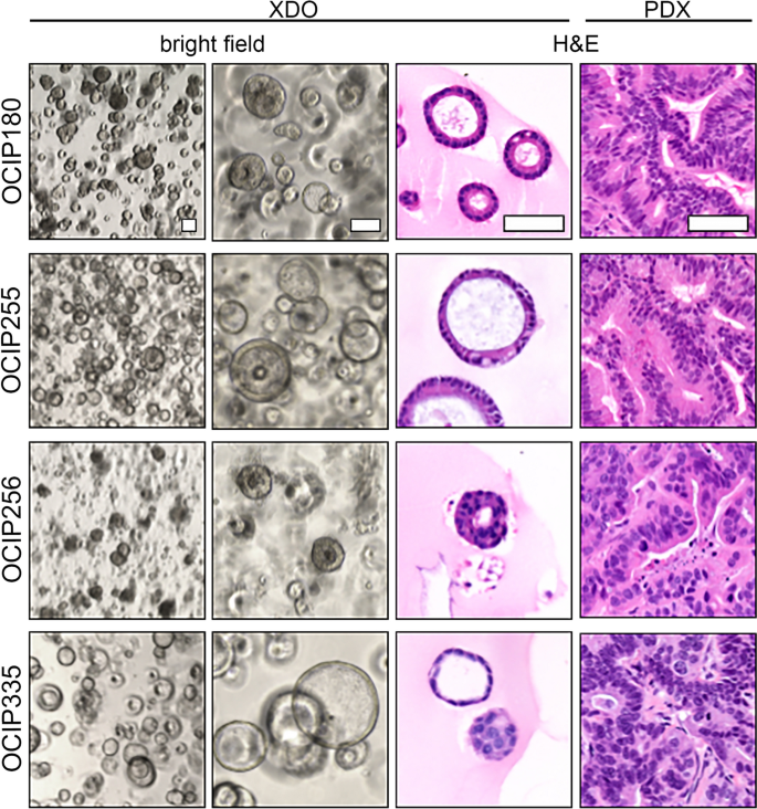 Patient-derived tumor xenograft and organoid models established from resected pancreatic, duodenal and biliary cancers
