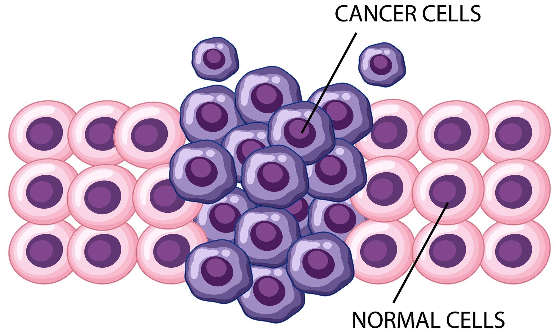 DNA Methylation-Based Classification of Small B-Cell Lymphomas: A Proof-of-Principle Study