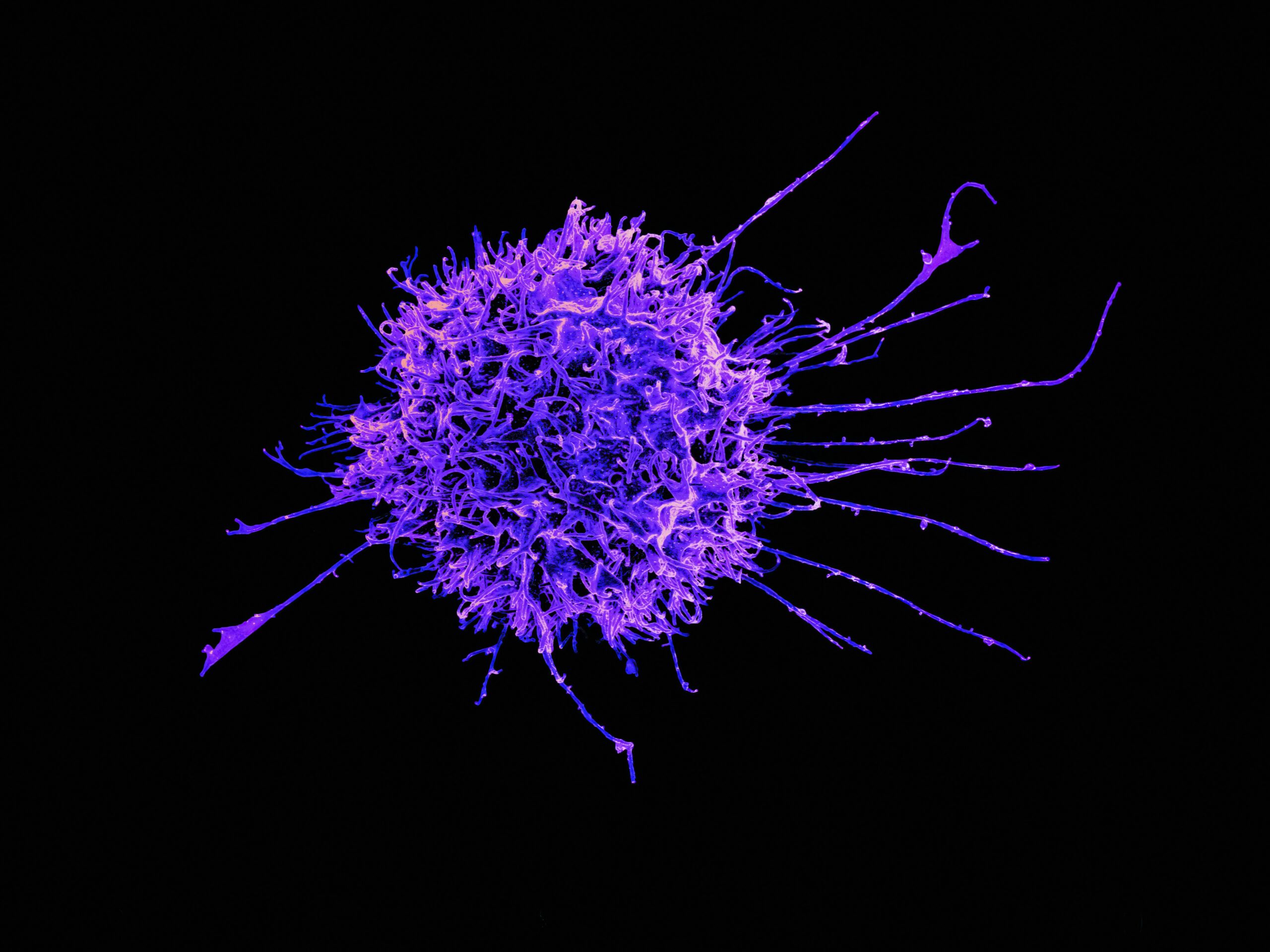 In-depth characterization of intratumoral heterogeneity in refractory B-cell non-Hodgkin lymphoma through the lens of a Research Autopsy Program